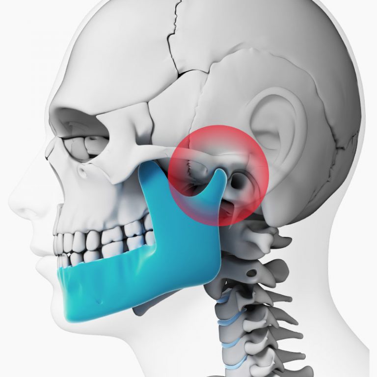 Miami Center For Craniomandibular Disorders – Dr Franklin Del Rio